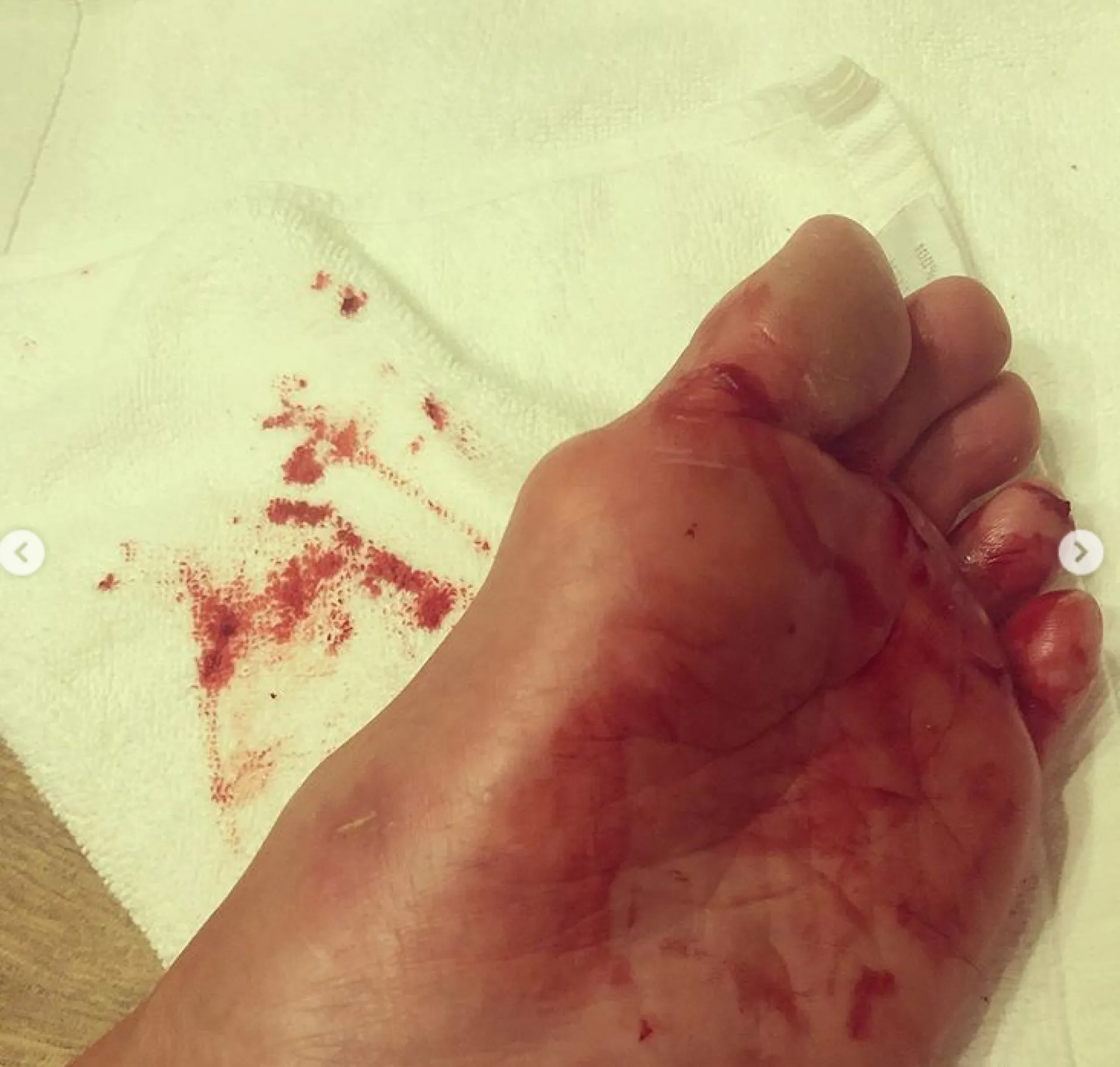 Волочкова попала в больницу