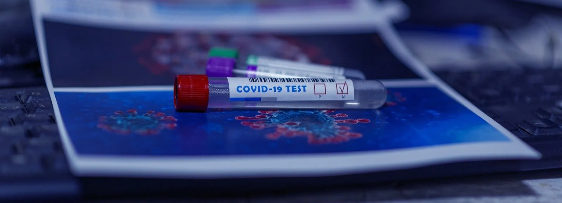 475 новых случаев заболевания COVID-19 выявили за прошедшие сутки в Алтайском крае