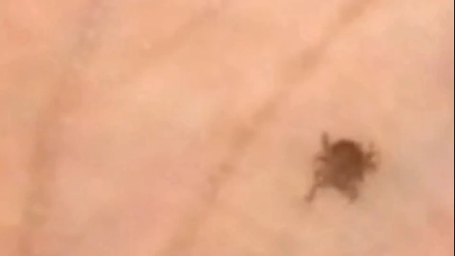 Жители Новосибирска обнаружили на собаке живого клеща в феврале Жители Новосибирска обнаружили на собаке живого клеща в феврале