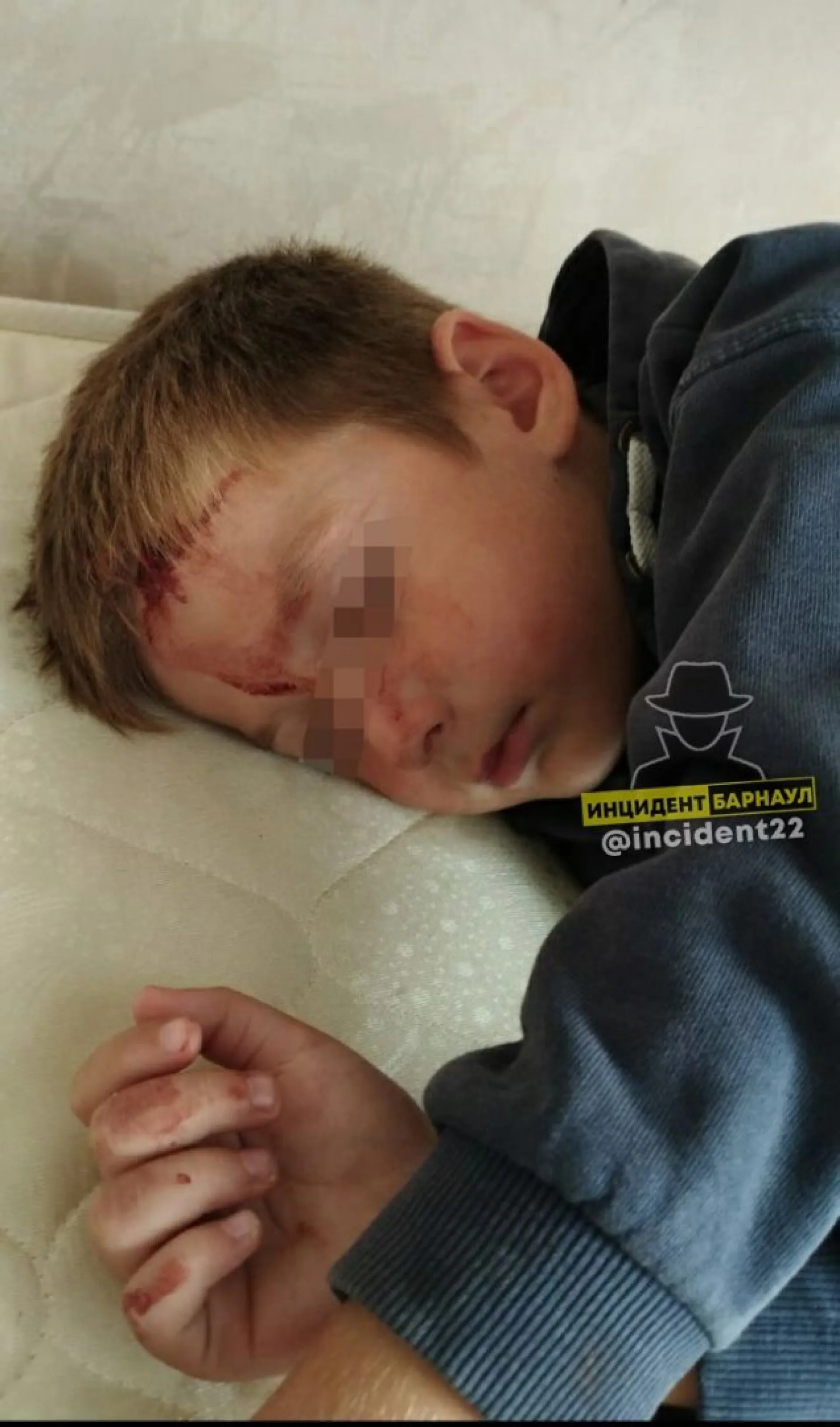 Соцсети: 5-летнего ребенка серьезно избили на детской площадке в Барнауле