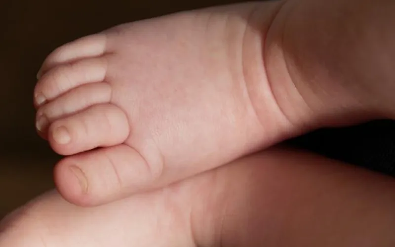 Ребёнок получил ожог обеих ног в ясельной группе в Барнауле 