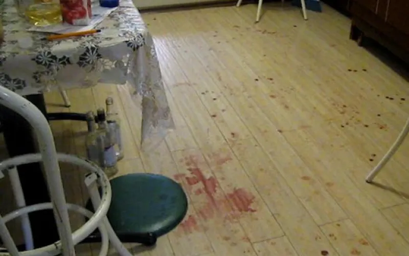 Мужчина по ошибке сломал челюсть жителю Ярового