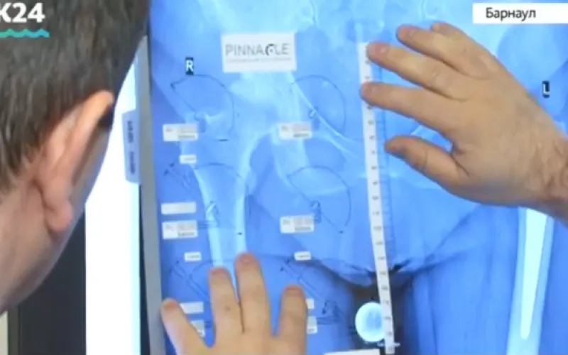 День травматолога отметили в Алтайском крае 