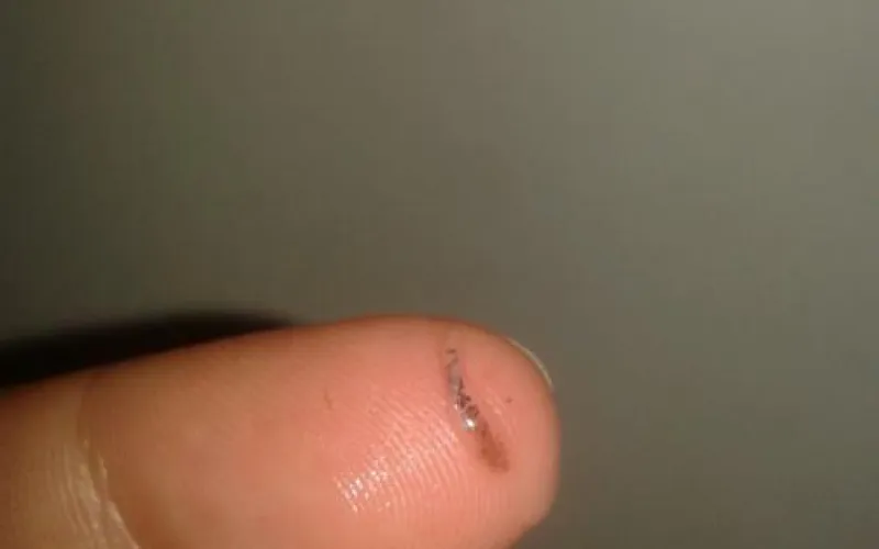 Жительница Бийска отправила «печень с червями» на экспертизу