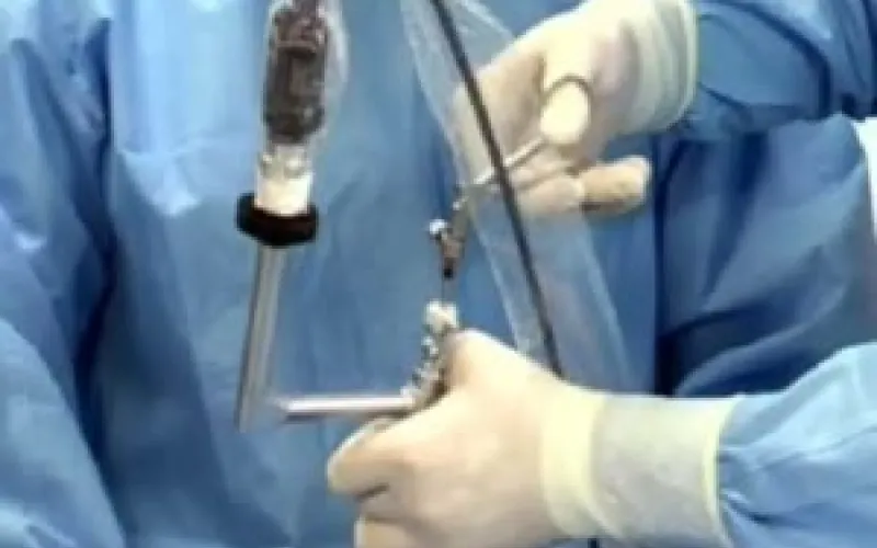 Уникальную операцию провели ребёнку в Алтайском крае