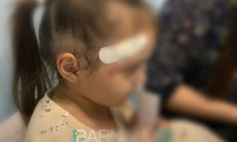 Электросамокатчик сбил 5-летнюю девочку в Барнауле